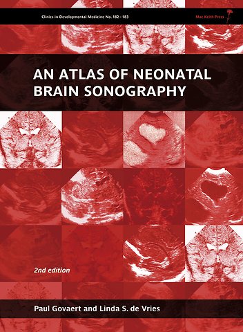 An Atlas of Neonatal Brain Sonography