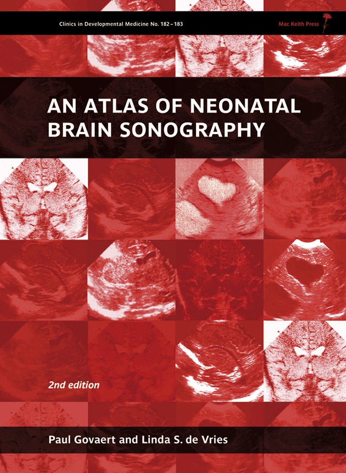 An Atlas of Neonatal Brain Sonography