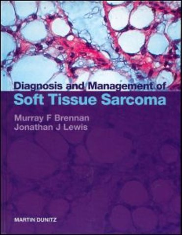 Diagnosis and Management of Soft Tissue Sarcoma
