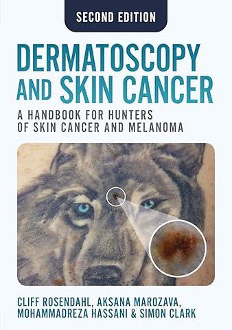 Dermatoscopy and Skin Cancer, second edition
