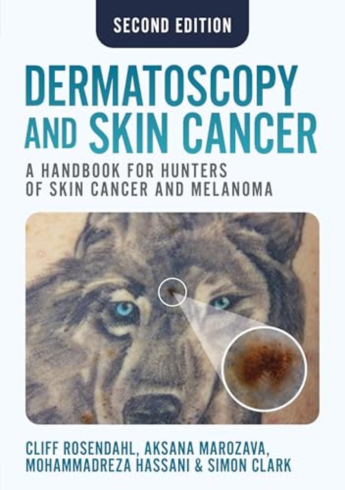 Dermatoscopy and Skin Cancer, second edition