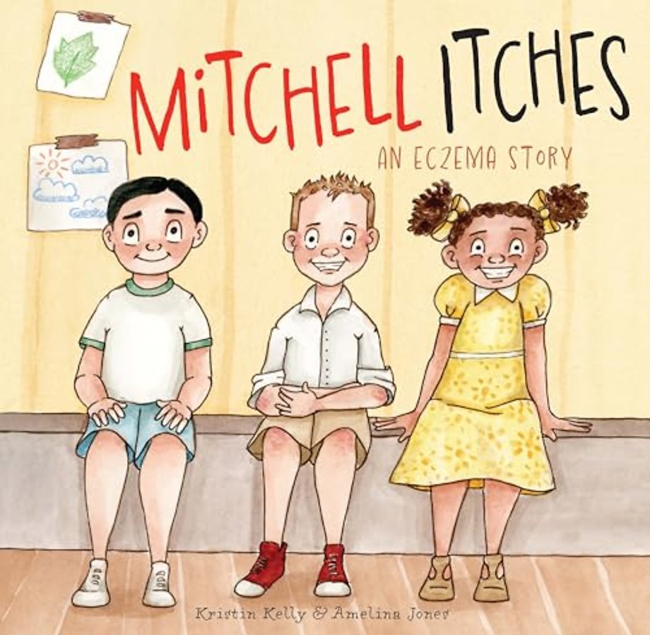 Mitchell Itches