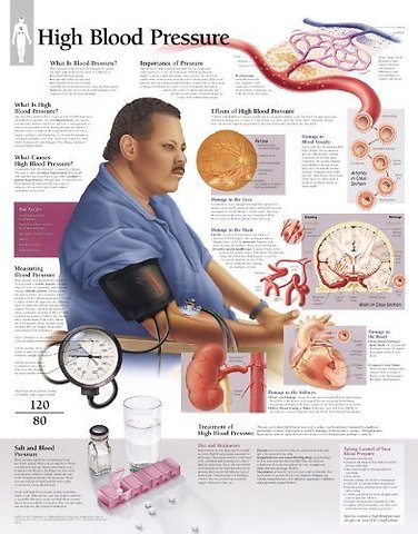 High Blood Pressure Paper Poster