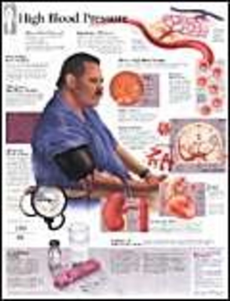 High Blood Pressure Laminated Poster