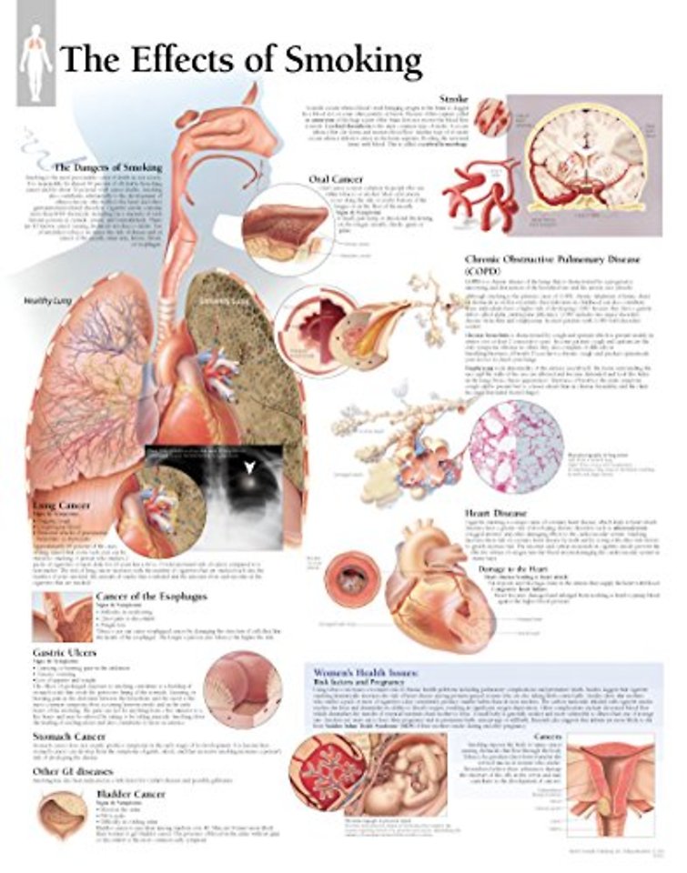 Effects of Smoking Paper Poster