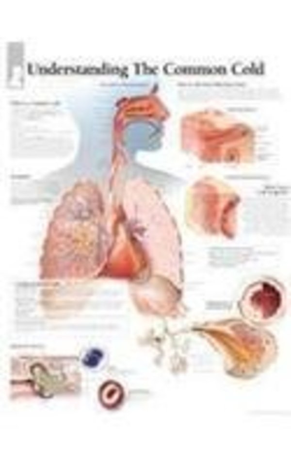 Understanding the Common Cold Laminated Poster