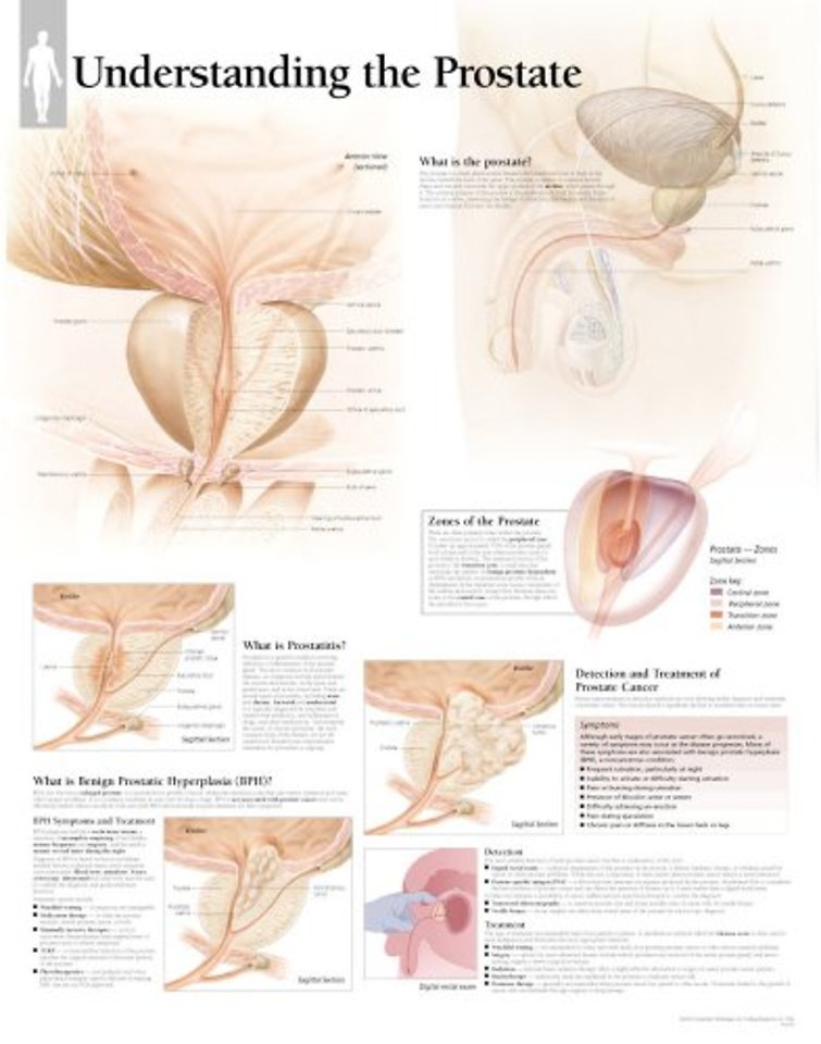 Understanding the Prostate Laminated Poster