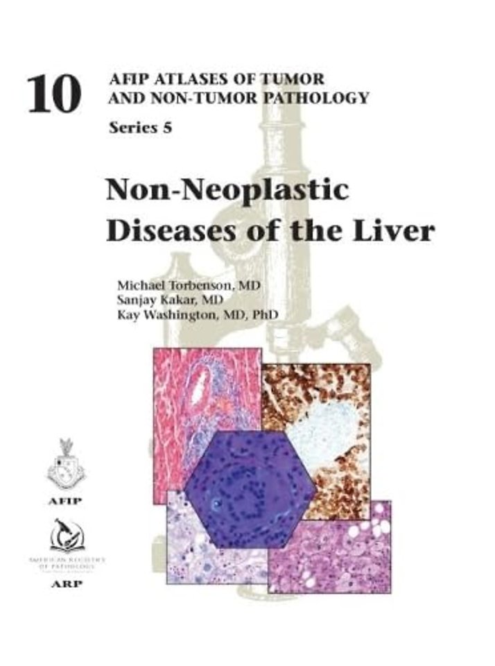 Non–Neoplastic Diseases of the Liver