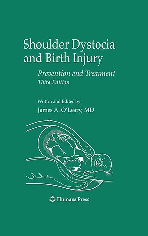 Shoulder Dystocia and Birth Injury