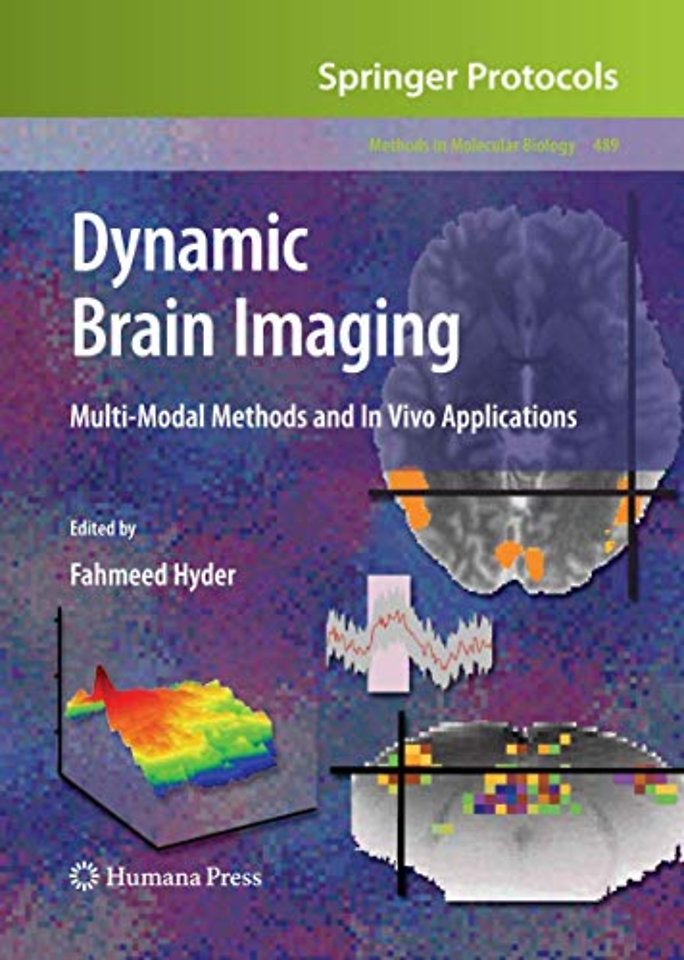 Dynamic Brain Imaging