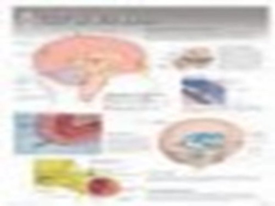 CSF & the Brain Laminated Poster