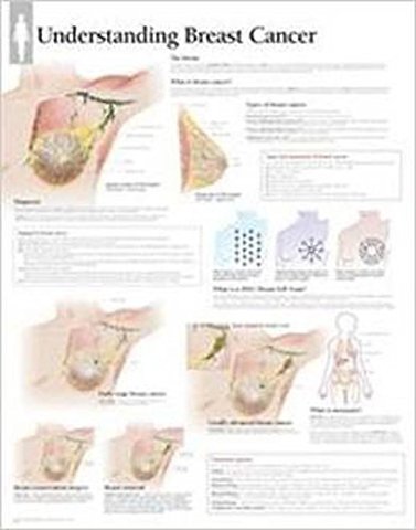 Understanding Breast Cancer Paper Poster