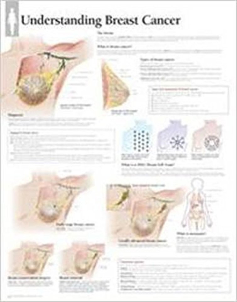 Understanding Breast Cancer Paper Poster