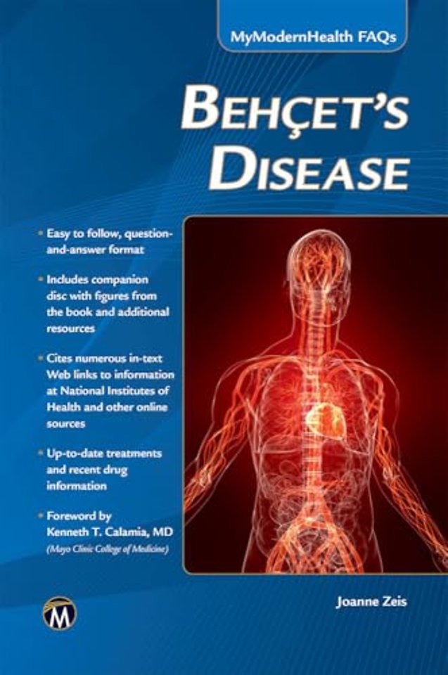 Behcet′s Disease
