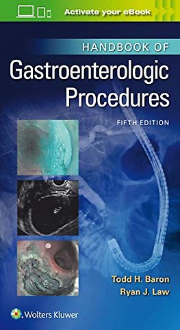 Handbook of Gastroenterologic Procedures
