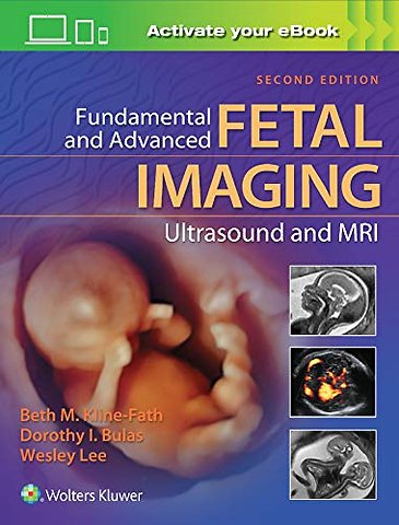 Fundamental and Advanced Fetal Imaging Ultrasound and MRI