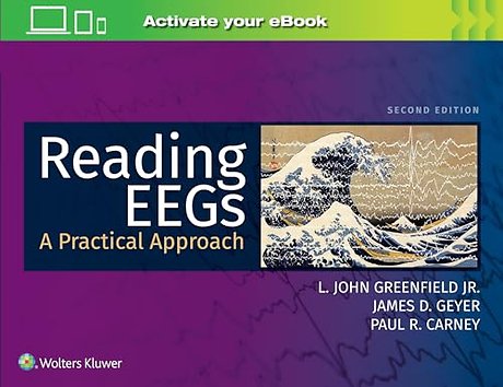 Reading EEGs: A Practical Approach