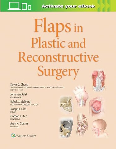 Flaps in Plastic and Reconstructive Surgery