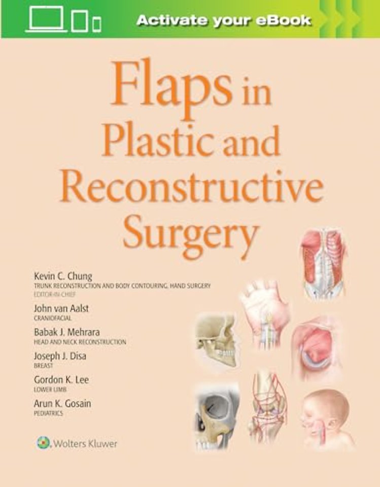 Flaps in Plastic and Reconstructive Surgery
