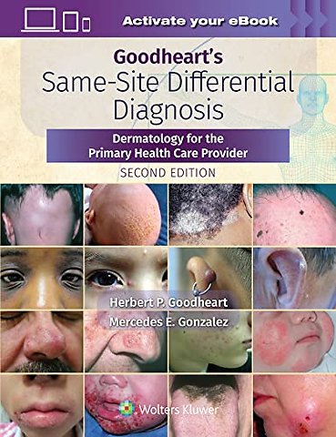 Goodheart's Same-Site Differential Diagnosis