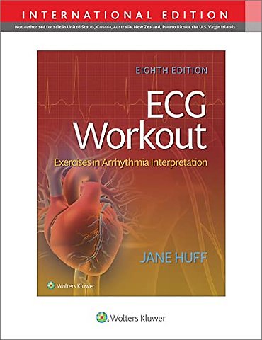 ECG Workout