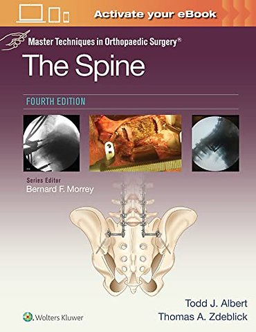 Master Techniques in Orthopaedic Surgery: The Spine