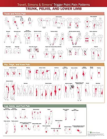 Travell, Simons & Simons’ Trigger Point Pain Patterns Wall Chart