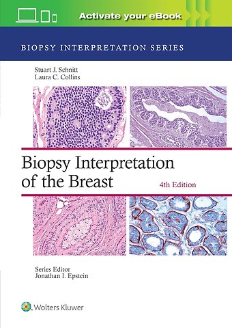 Biopsy Interpretation of the Breast