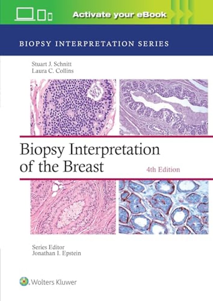 Biopsy Interpretation of the Breast