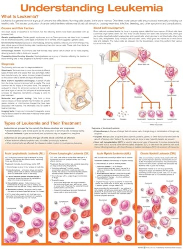 Understanding Leukemia Anatomical Chart