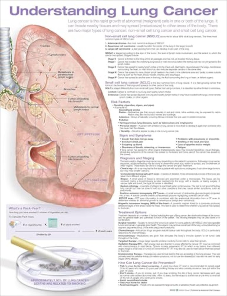 Understanding Lung Cancer Anatomical Chart