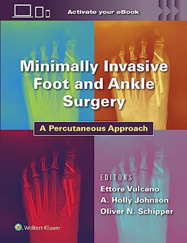 Minimally Invasive Foot and Ankle Surgery
