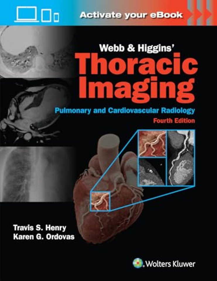 Webb & Higgins Thoracic Imaging: Print + eBook with Multimedia