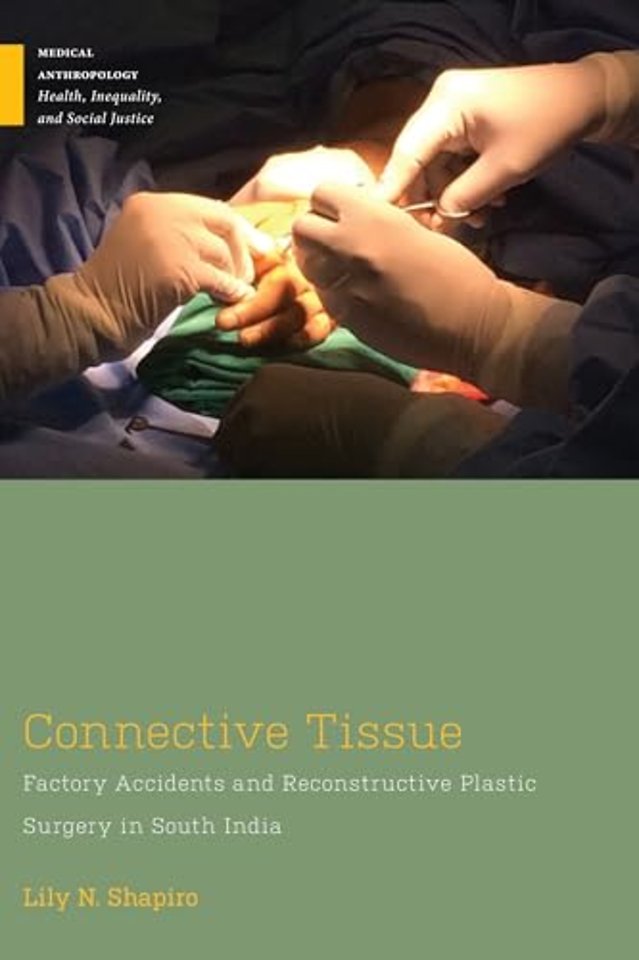 Connective Tissue – Factory Accidents and Reconstructive Plastic Surgery in South India