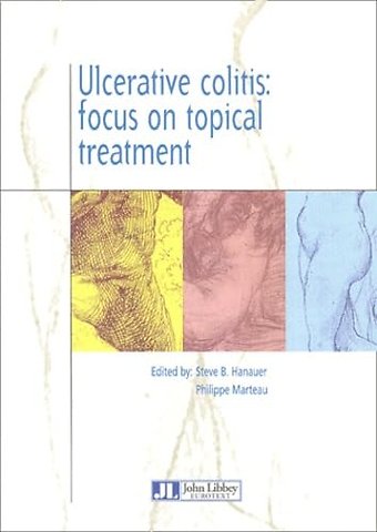 Ulcerative Colitis