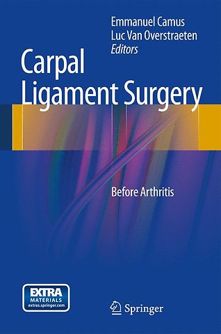 Carpal Ligament Surgery