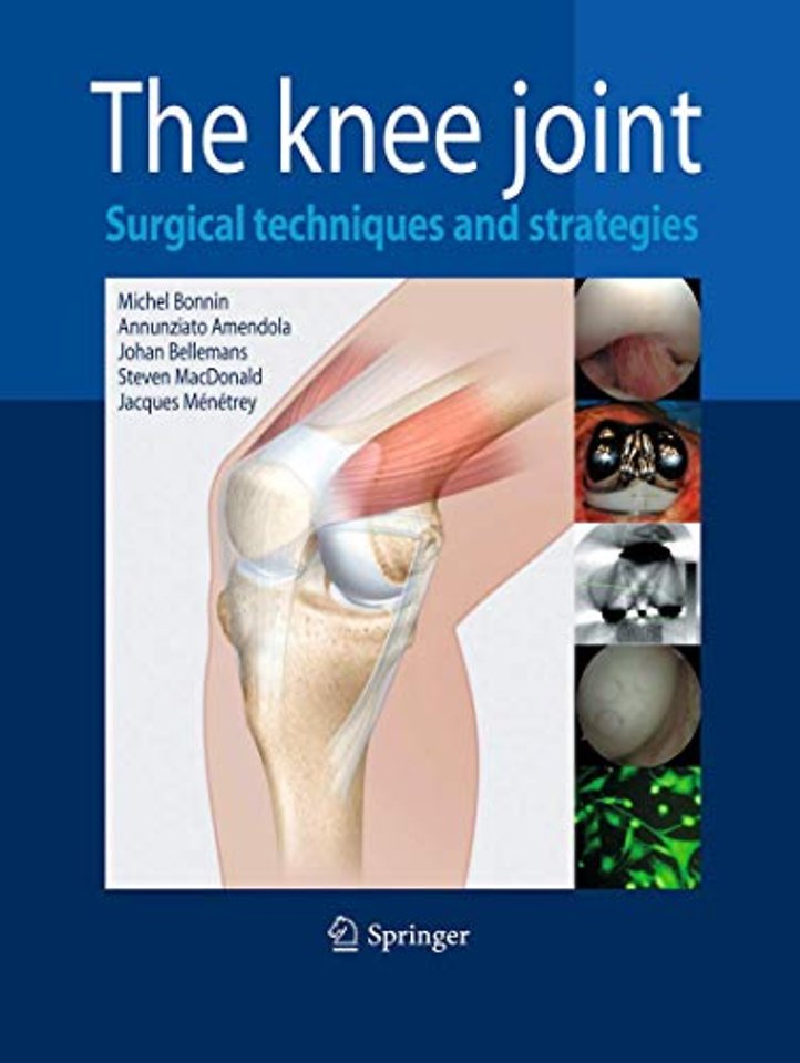 The Knee Joint