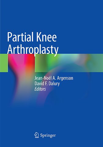 Partial Knee Arthroplasty