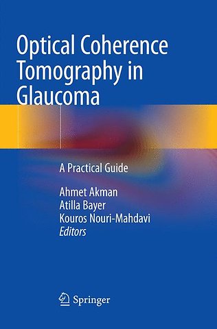 Optical Coherence Tomography in Glaucoma