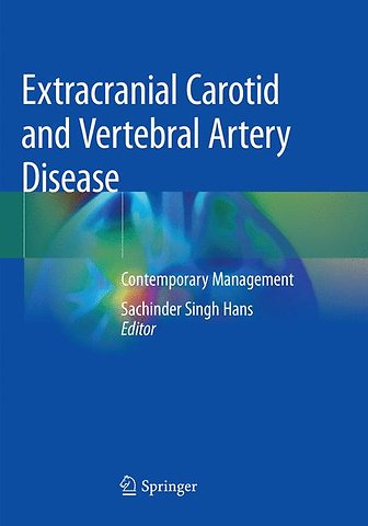 Extracranial Carotid and Vertebral Artery Disease