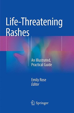 Life-Threatening Rashes