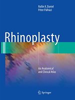 Rhinoplasty
