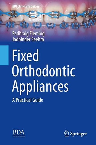 Fixed Orthodontic Appliances