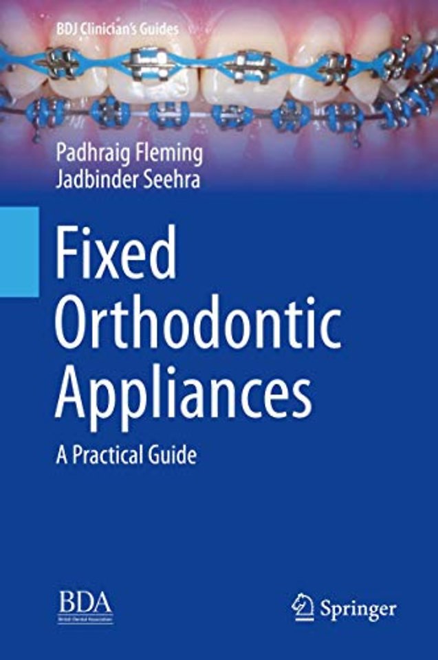 Fixed Orthodontic Appliances
