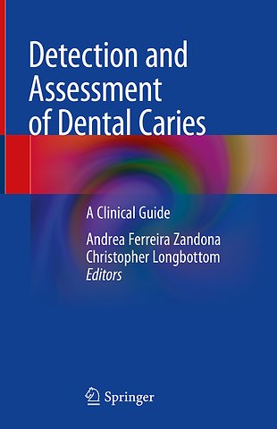 Detection and Assessment of Dental Caries