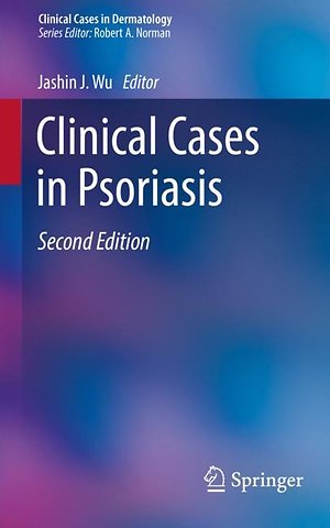 Clinical Cases in Psoriasis