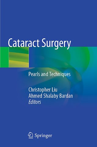 Cataract Surgery