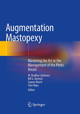 Augmentation Mastopexy