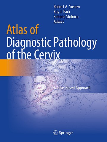 Atlas of Diagnostic Pathology of the Cervix