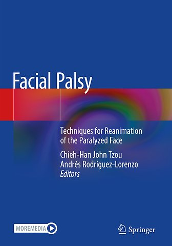 Facial Palsy